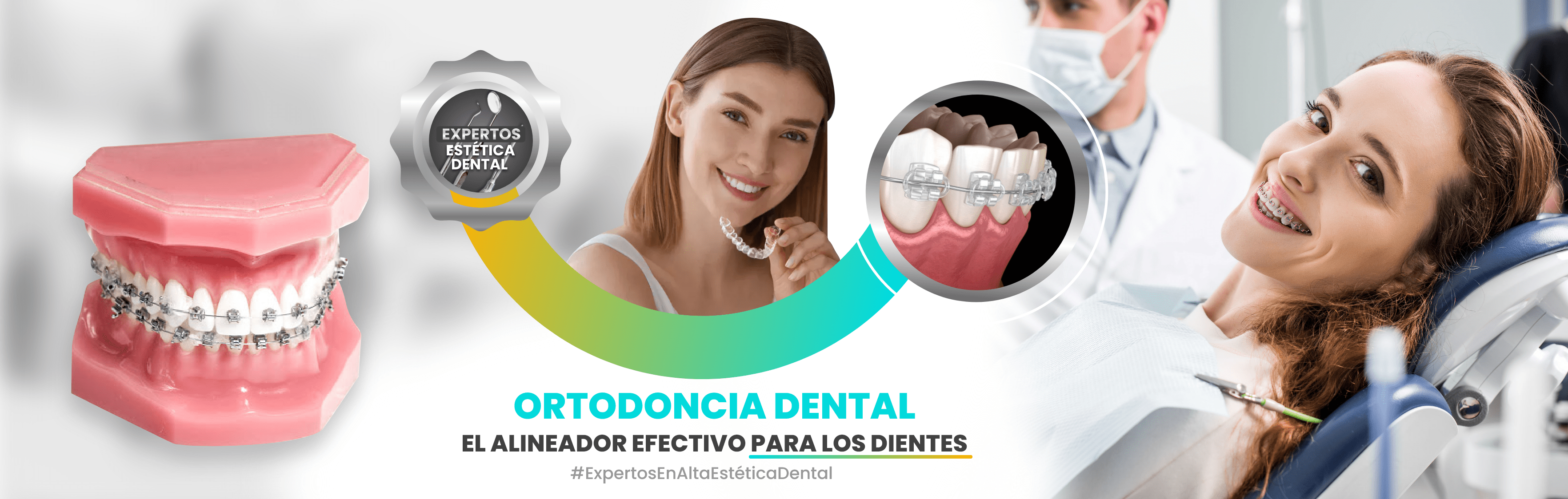 Como limpiar los alineadores dentales - Clínica dental Díaz López