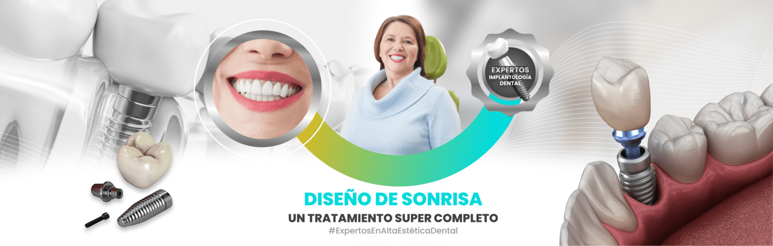 Implantes Dentales Por Pieza Dental Cop El Salvador 6044