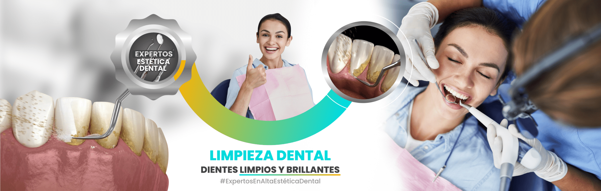 Como limpiar los alineadores dentales - Clínica dental Díaz López (Estadio  Ramón de Carranza)