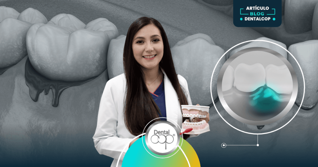Sangrado al cepillarme los dientes