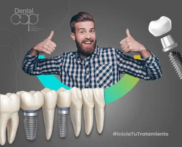 Servicio dental de implantología dental unitaria